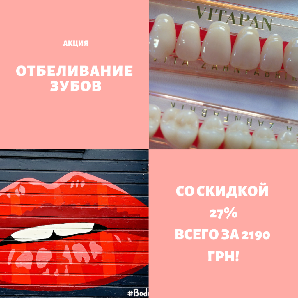 отбеливание зубов акция Киев